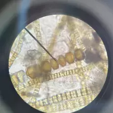 Mikroglony – okrzemki widziane pod mikroskopem